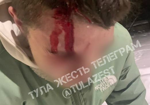 В посёлке Барсуки в Туле снежная глыба упала на голову подростку