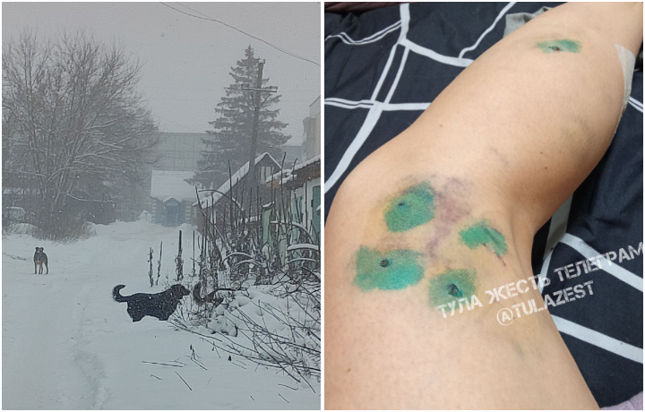 Жители Плавска пожаловались на участившиеся случаи нападения бездомных псов