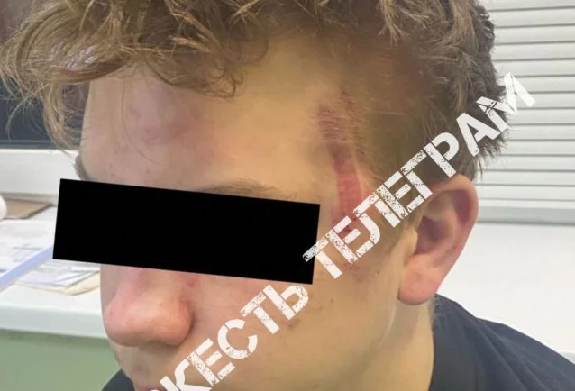 В Туле взрослый мужчина избил подростка