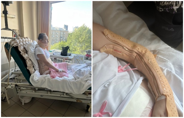 Тулячка, пострадавшая после атаки БПЛА: Я жива, врачи вытащили с того света