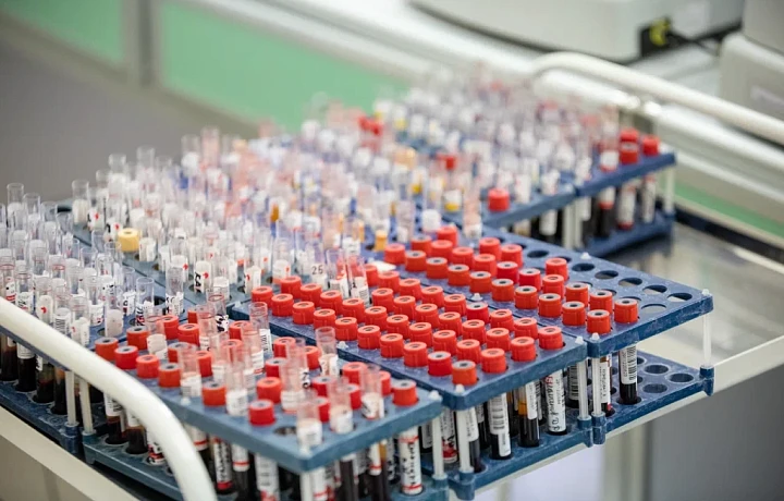 Туляки смогут бесплатно пройти анонимное тестирование на ВИЧ