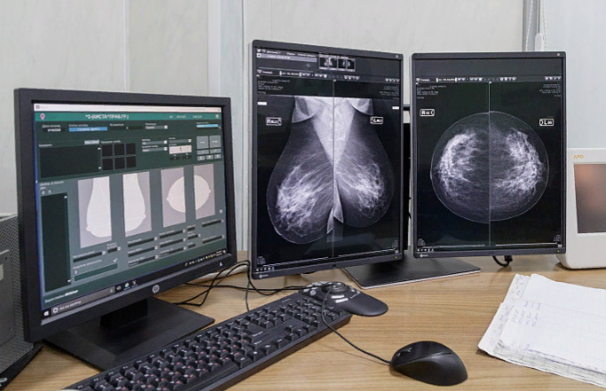 Больше 900 тулячек прошли маммографию в поликлинике онкодиспансера