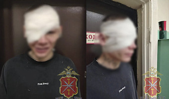 Ударил бокалом по лицу: Полиция проверяет информацию о драке посетителей в кафе Кимовска