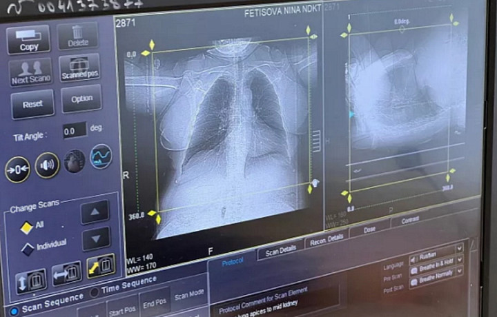 За сутки подозрение на рак обнаружили у семи жителей Тульской области