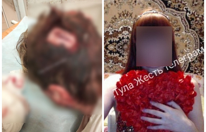 Стали известны подробности нападения на врача-педиатра в тульском поселке Рассвет