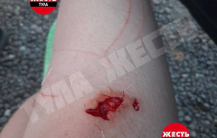 В Туле на пруду Голубушка девочку укусила ондатра