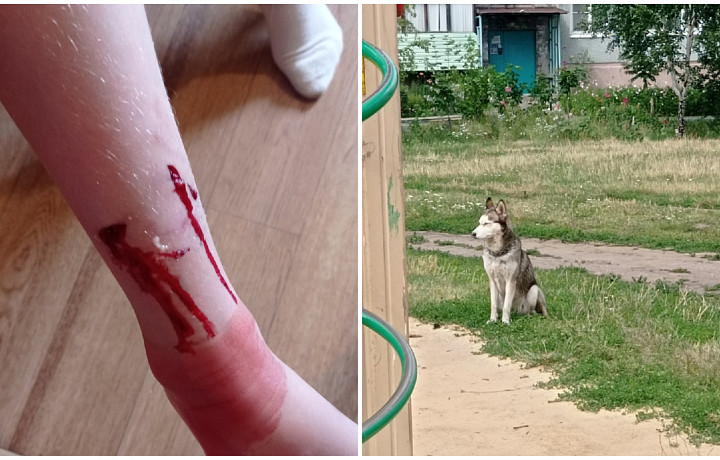 В одном из дворов Новомосковска собака покусала ребенка