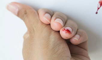 «Мама, у меня ногти оторвались»: чем опасно для детей раннее наращивание ногтей