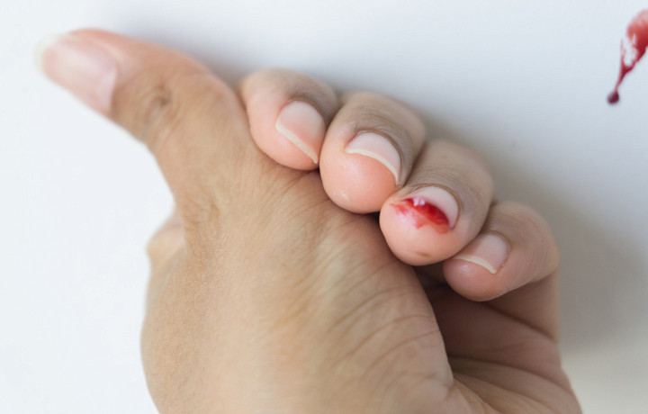 «Мама, у меня ногти оторвались»: чем опасно для детей раннее наращивание ногтей