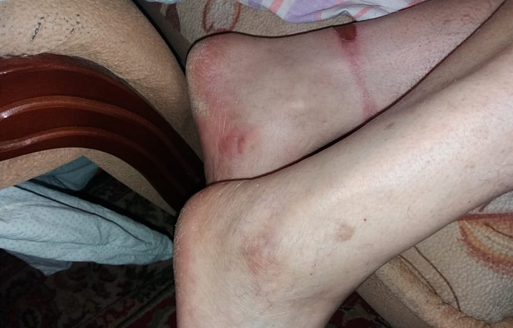 Жительница Тульской области пожаловалась на издевательства над ее отцом в горбольнице