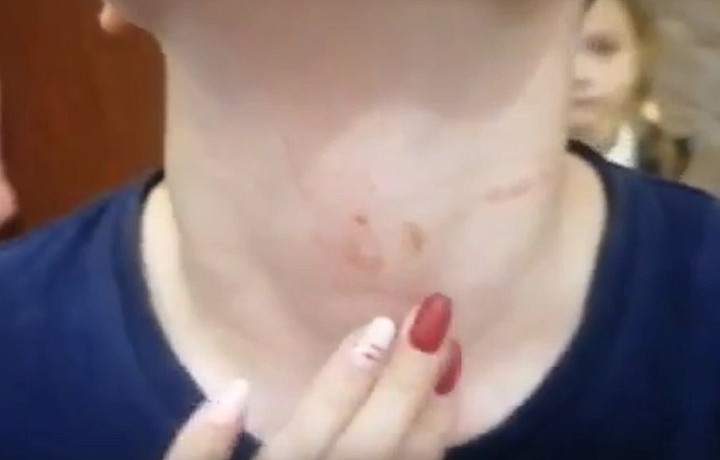 Больше не работает: в Тульской области уволили учительницу, которая пыталась задушить ребёнка