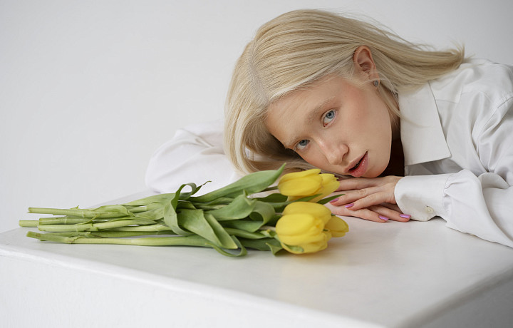 «Витамин D усваивается в 5 раз быстрее, красная радужка глаз – фотошопный фейк»: что такое альбинизм и на что влияет заболевание