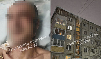 Упавшая сосулька разбила голову мужчине на улице Плеханова в Туле