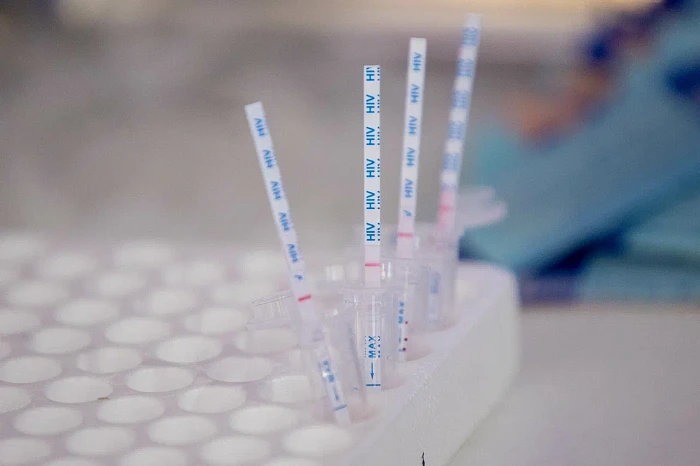 Около 250 жителей Тульской области проверили свой ВИЧ-статус
