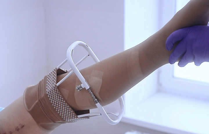 В тульской клинике «Варикоза нет» рассказали, как на выгодных условиях получить консультацию хирурга-флеболога