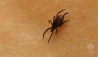 В Тульской области каждый восьмой клещ заражен боррелиями: все чаще фиксируют и анаплазмоз