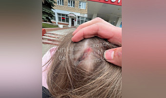 СК завёл уголовное дело после нападения на подростка в автобусе в Новомосковске