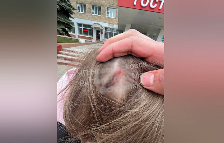 СК завёл уголовное дело после нападения на подростка в автобусе в Новомосковске