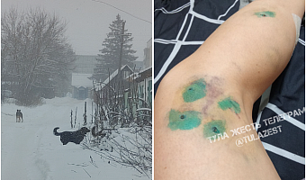 Жители Плавска пожаловались на участившиеся случаи нападения бездомных псов