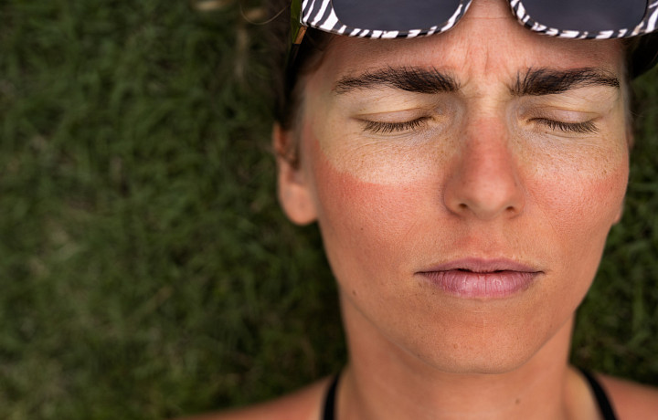 Усталость, морщинки, сухость и пятнышки пигментации: план спасения кожи после лета