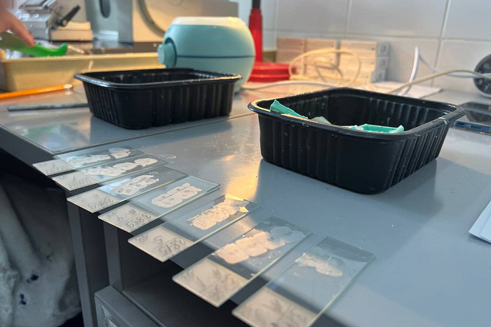 Диагностика, спасающая жизнь: тульский патологоанатом развеял мифы о своей работе