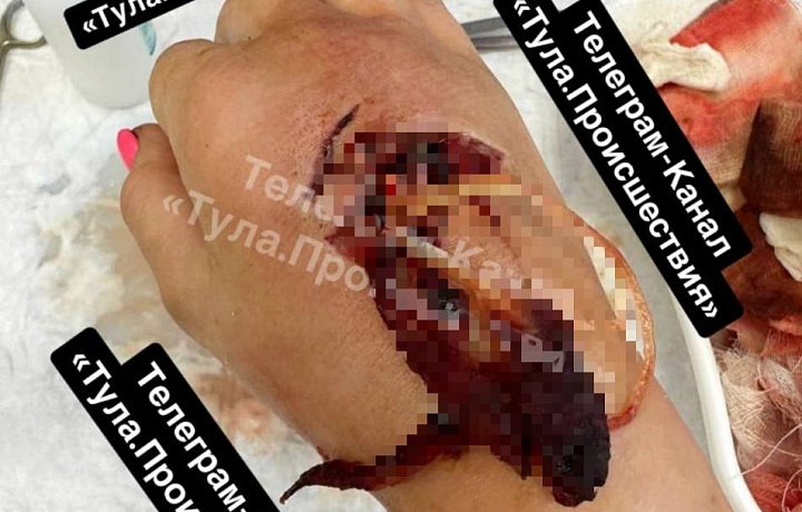 На зооферме под Алексином медведь напал на девочку и травмировал ее мать