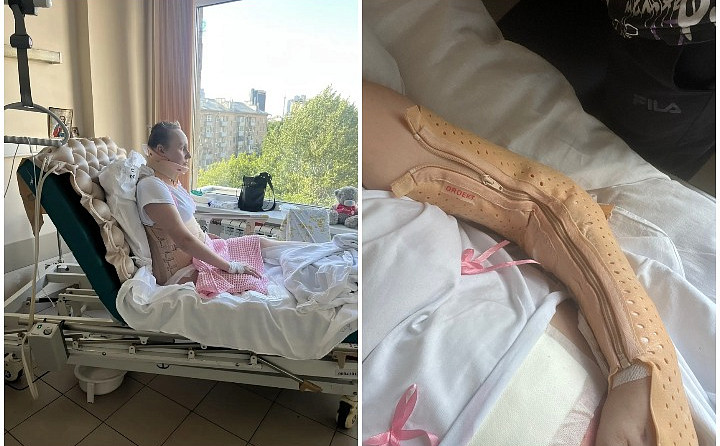 Тулячка, пострадавшая после атаки БПЛА: Я жива, врачи вытащили с того света