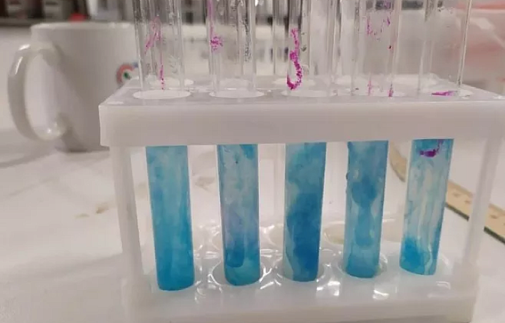 Юная тулячка нашла неинвазивный способ измерения уровня глюкозы в крови человека