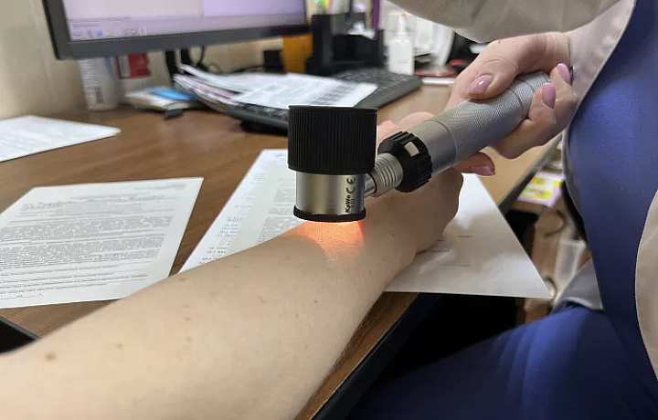 Жители Тульской области проверили родинки на онкологию