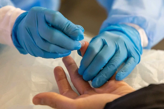 Около 250 жителей Тульской области проверили свой ВИЧ-статус