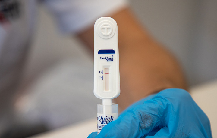 Специалисты напомнили о важности ежегодного тестирования на ВИЧ-инфекцию