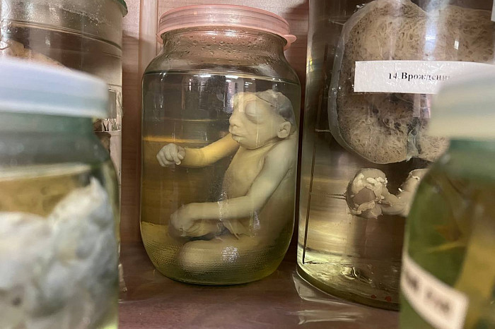 Диагностика, спасающая жизнь: тульский патологоанатом развеял мифы о своей работе