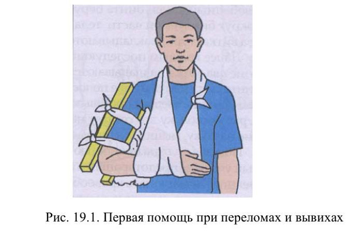 Это должен знать каждый: как правильно оказать помощь в экстренных ситуациях – при переломе, кровотечении или приступе эпилепсии