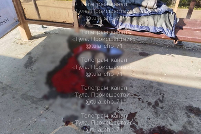 Мужчину, который жил на остановке у «Искры» в Туле, доставили в больницу с разбитым лицом