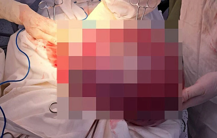 Фото: министерство здравоохранения Тульской области